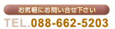 お気軽にお問い合わせ下さい｜TEL.088-662-5203